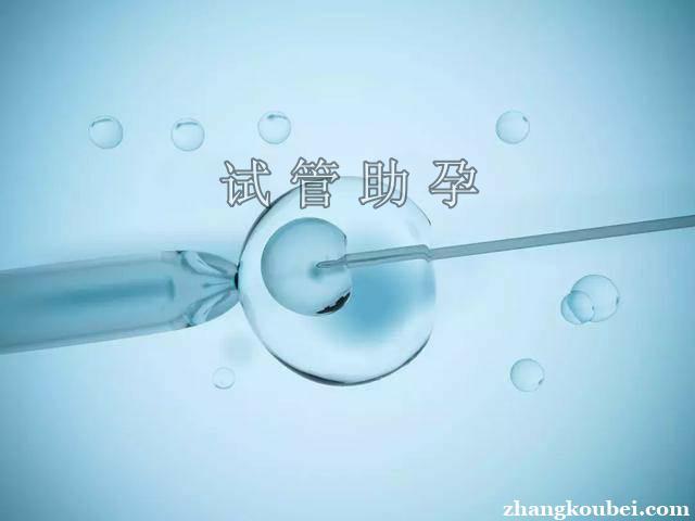 试管婴儿借卵(试管婴儿借卵:新生命的奇迹)