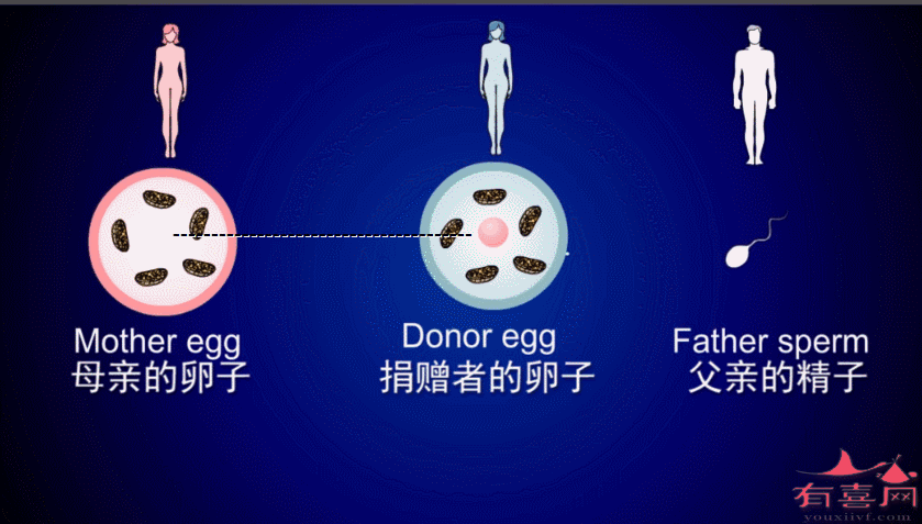 借卵试管代怀双胞胎零风险-借卵试管代怀双胞胎零风险：安全可靠的选择