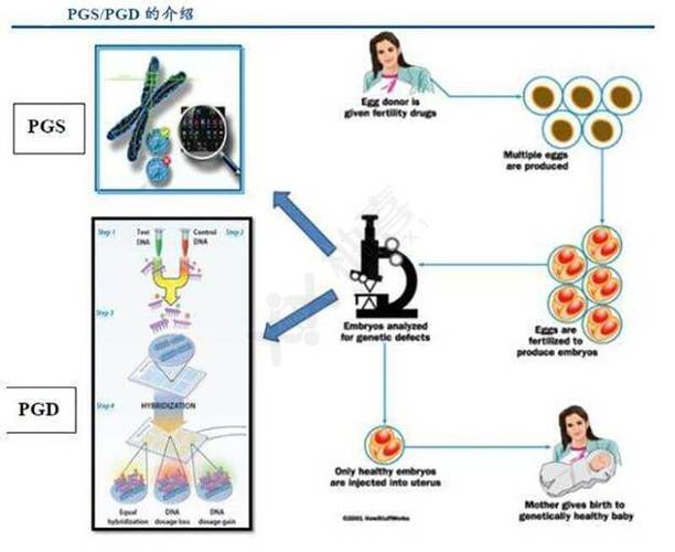 三代供卵试管_三代供卵试管技术的发展与应用